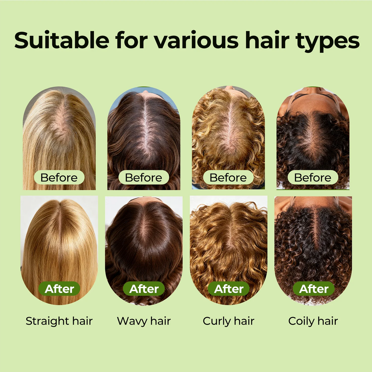Biotin - Advanced Beauty Formula
